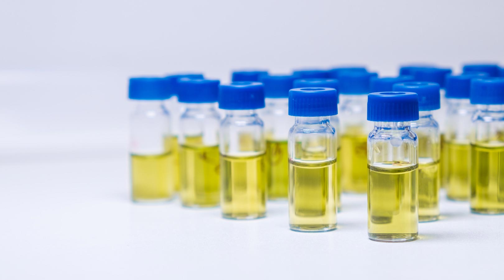 Urine Test image